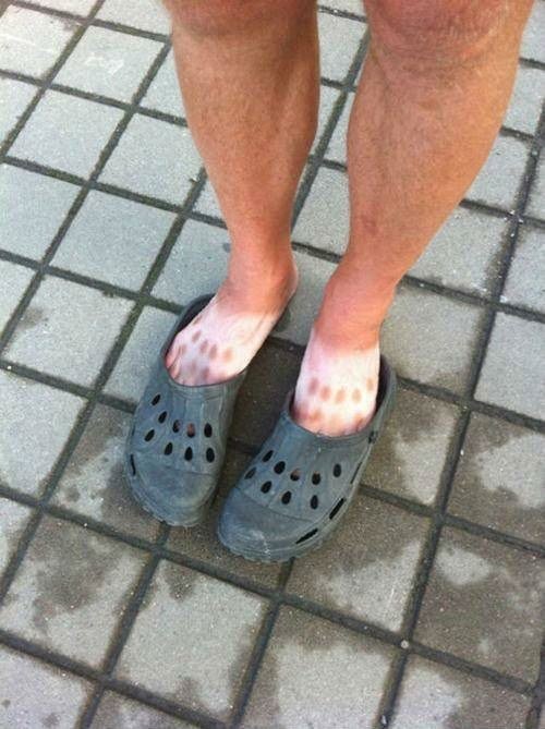 Who should stay away from the beach? Guys (and girls) with Crocs 